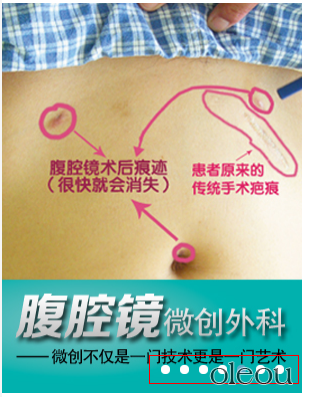 JS图片焦点切换